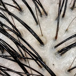 Example scan: scalp, follicles and strands magnified 100 times